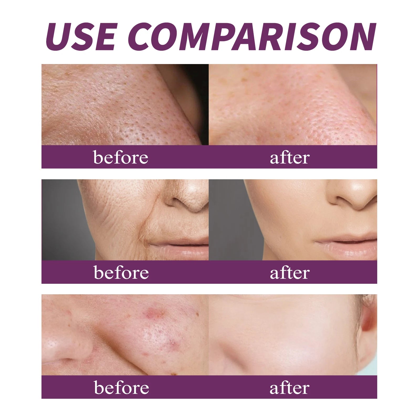 Anti-aging concentrate with 20% niacinamide B3 to combat discoloration and minimize enlarged pores. Fragrance and paraben-free. 20 ml.
