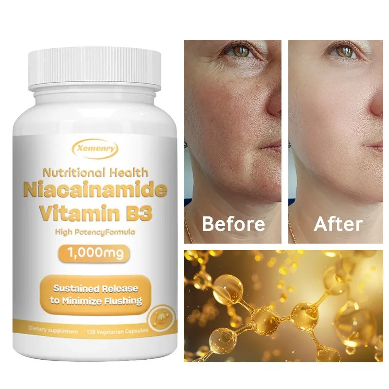 Cápsulas de niacinamida (vitamina B3): favorecen la función cerebral y la salud cardiovascular, aumentan la producción de energía y refuerzan el sistema inmunitario.